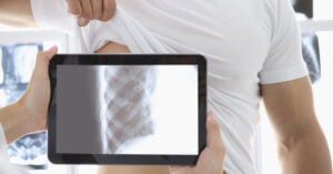 Filing a Claim for Broken Ribs Suffered in a Minneapolis Car Crash